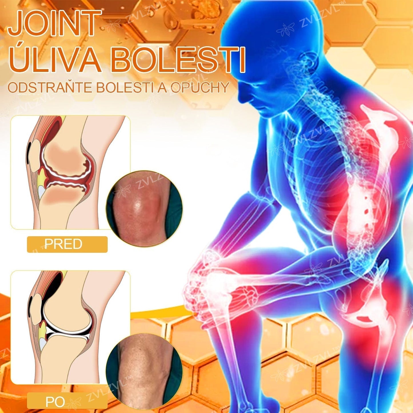𝐙𝐕𝐋𝐙𝐕𝐋™ 𝐕č𝐞𝐥í 𝐣𝐞𝐝 𝐨𝐤𝐚𝐦ž𝐢𝐭ý 𝐮𝐥𝐭𝐫𝐚 𝐬𝐢𝐥𝐧ý 𝐤𝐫é𝐦 𝐩𝐫𝐨𝐭𝐢 𝐛𝐨𝐥𝐞𝐬𝐭𝐢 - (𝐳𝐦𝐢𝐞𝐫ň𝐮𝐣𝐞 𝐛𝐨𝐥𝐞𝐬ť 𝐩𝐫𝐢 𝐚𝐫𝐭𝐫𝐢𝐭í𝐝𝐞, 𝐛𝐨𝐥𝐞𝐬𝐭𝐢 𝐬𝐯𝐚𝐥𝐨𝐯, 𝐜𝐡𝐫𝐛𝐭𝐚, 𝐤𝐨𝐥𝐢𝐞𝐧, 𝐜𝐡𝐫𝐛𝐭𝐚, 𝐫𝐚𝐦𝐢𝐞𝐧, 𝐛𝐨𝐤𝐨𝐯, 𝐳á𝐩ä𝐬𝐭í, 𝐫ú𝐤)