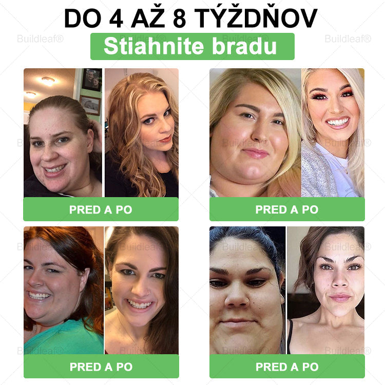 🐝BuildLeaf® GLP-1 6-v-1 Health Solution Perorálna tekutina (Len raz denne, viditeľné zmeny už za 7 dní) Pre obezitu, kardiovaskulárne ochorenia, cukrovku, spánkové apnoe, zdravie čriev, problémy s kĺbmi a ďalšie