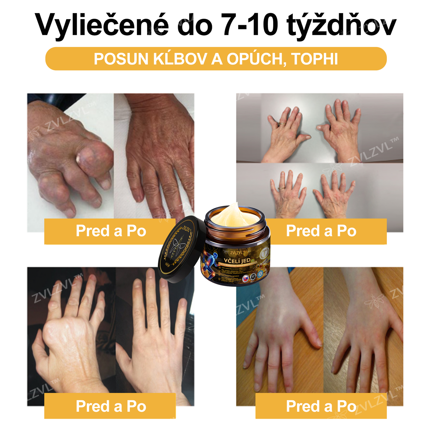 𝐙𝐕𝐋𝐙𝐕𝐋™ 𝐕č𝐞𝐥í 𝐣𝐞𝐝 𝐨𝐤𝐚𝐦ž𝐢𝐭ý 𝐮𝐥𝐭𝐫𝐚 𝐬𝐢𝐥𝐧ý 𝐤𝐫é𝐦 𝐩𝐫𝐨𝐭𝐢 𝐛𝐨𝐥𝐞𝐬𝐭𝐢 - (𝐳𝐦𝐢𝐞𝐫ň𝐮𝐣𝐞 𝐛𝐨𝐥𝐞𝐬ť 𝐩𝐫𝐢 𝐚𝐫𝐭𝐫𝐢𝐭í𝐝𝐞, 𝐛𝐨𝐥𝐞𝐬𝐭𝐢 𝐬𝐯𝐚𝐥𝐨𝐯, 𝐜𝐡𝐫𝐛𝐭𝐚, 𝐤𝐨𝐥𝐢𝐞𝐧, 𝐜𝐡𝐫𝐛𝐭𝐚, 𝐫𝐚𝐦𝐢𝐞𝐧, 𝐛𝐨𝐤𝐨𝐯, 𝐳á𝐩ä𝐬𝐭í, 𝐫ú𝐤)