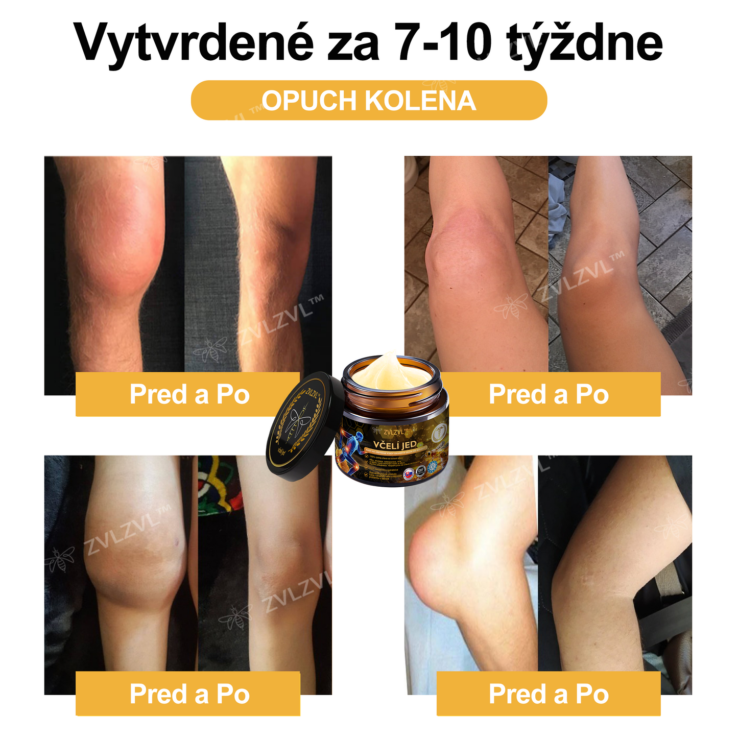 𝐙𝐕𝐋𝐙𝐕𝐋™ 𝐕č𝐞𝐥í 𝐣𝐞𝐝 𝐨𝐤𝐚𝐦ž𝐢𝐭ý 𝐮𝐥𝐭𝐫𝐚 𝐬𝐢𝐥𝐧ý 𝐤𝐫é𝐦 𝐩𝐫𝐨𝐭𝐢 𝐛𝐨𝐥𝐞𝐬𝐭𝐢 - (𝐳𝐦𝐢𝐞𝐫ň𝐮𝐣𝐞 𝐛𝐨𝐥𝐞𝐬ť 𝐩𝐫𝐢 𝐚𝐫𝐭𝐫𝐢𝐭í𝐝𝐞, 𝐛𝐨𝐥𝐞𝐬𝐭𝐢 𝐬𝐯𝐚𝐥𝐨𝐯, 𝐜𝐡𝐫𝐛𝐭𝐚, 𝐤𝐨𝐥𝐢𝐞𝐧, 𝐜𝐡𝐫𝐛𝐭𝐚, 𝐫𝐚𝐦𝐢𝐞𝐧, 𝐛𝐨𝐤𝐨𝐯, 𝐳á𝐩ä𝐬𝐭í, 𝐫ú𝐤)