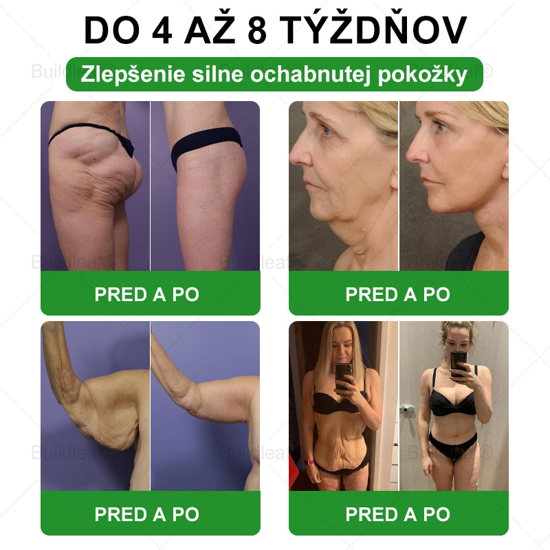 🐝BuildLeaf® GLP-1 6-v-1 Health Solution Perorálna tekutina (Len raz denne, viditeľné zmeny už za 7 dní) Pre obezitu, kardiovaskulárne ochorenia, cukrovku, spánkové apnoe, zdravie čriev, problémy s kĺbmi a ďalšie