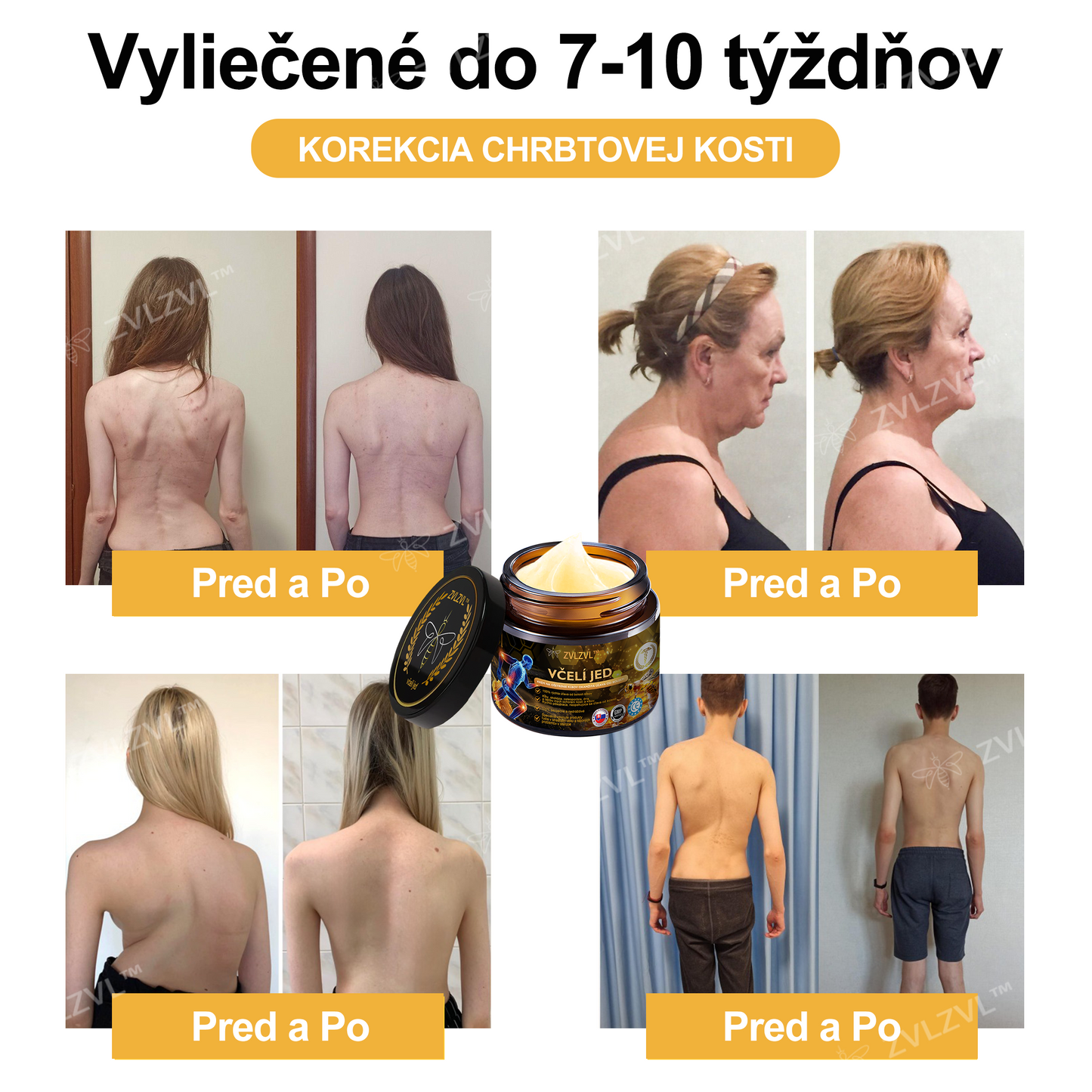 𝐙𝐕𝐋𝐙𝐕𝐋™ 𝐕č𝐞𝐥í 𝐣𝐞𝐝 𝐨𝐤𝐚𝐦ž𝐢𝐭ý 𝐮𝐥𝐭𝐫𝐚 𝐬𝐢𝐥𝐧ý 𝐤𝐫é𝐦 𝐩𝐫𝐨𝐭𝐢 𝐛𝐨𝐥𝐞𝐬𝐭𝐢 - (𝐳𝐦𝐢𝐞𝐫ň𝐮𝐣𝐞 𝐛𝐨𝐥𝐞𝐬ť 𝐩𝐫𝐢 𝐚𝐫𝐭𝐫𝐢𝐭í𝐝𝐞, 𝐛𝐨𝐥𝐞𝐬𝐭𝐢 𝐬𝐯𝐚𝐥𝐨𝐯, 𝐜𝐡𝐫𝐛𝐭𝐚, 𝐤𝐨𝐥𝐢𝐞𝐧, 𝐜𝐡𝐫𝐛𝐭𝐚, 𝐫𝐚𝐦𝐢𝐞𝐧, 𝐛𝐨𝐤𝐨𝐯, 𝐳á𝐩ä𝐬𝐭í, 𝐫ú𝐤)