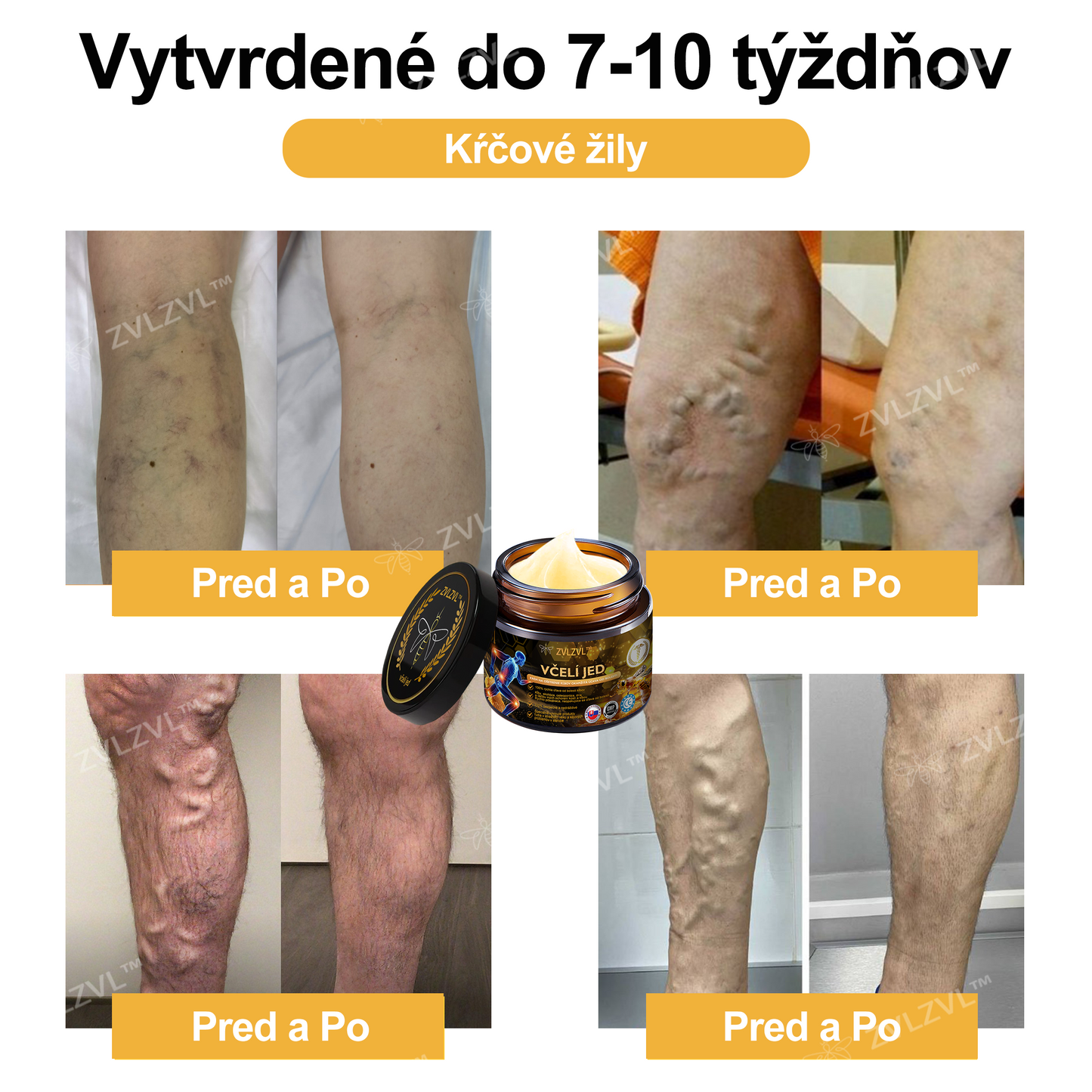 𝐙𝐕𝐋𝐙𝐕𝐋™ 𝐕č𝐞𝐥í 𝐣𝐞𝐝 𝐨𝐤𝐚𝐦ž𝐢𝐭ý 𝐮𝐥𝐭𝐫𝐚 𝐬𝐢𝐥𝐧ý 𝐤𝐫é𝐦 𝐩𝐫𝐨𝐭𝐢 𝐛𝐨𝐥𝐞𝐬𝐭𝐢 - (𝐳𝐦𝐢𝐞𝐫ň𝐮𝐣𝐞 𝐛𝐨𝐥𝐞𝐬ť 𝐩𝐫𝐢 𝐚𝐫𝐭𝐫𝐢𝐭í𝐝𝐞, 𝐛𝐨𝐥𝐞𝐬𝐭𝐢 𝐬𝐯𝐚𝐥𝐨𝐯, 𝐜𝐡𝐫𝐛𝐭𝐚, 𝐤𝐨𝐥𝐢𝐞𝐧, 𝐜𝐡𝐫𝐛𝐭𝐚, 𝐫𝐚𝐦𝐢𝐞𝐧, 𝐛𝐨𝐤𝐨𝐯, 𝐳á𝐩ä𝐬𝐭í, 𝐫ú𝐤)