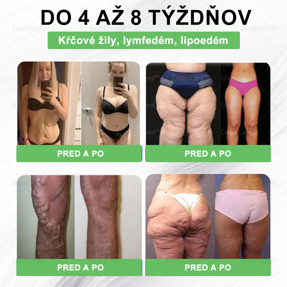 🐝BuildLeaf® GLP-1 6-v-1 Health Solution Perorálna tekutina (Len raz denne, viditeľné zmeny už za 7 dní) Pre obezitu, kardiovaskulárne ochorenia, cukrovku, spánkové apnoe, zdravie čriev, problémy s kĺbmi a ďalšie